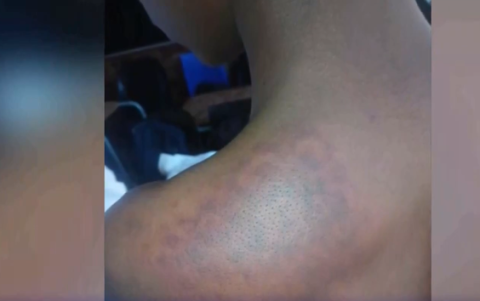 Violência escolar em Gauteng: 17 alunos agredidos por seguranças privados